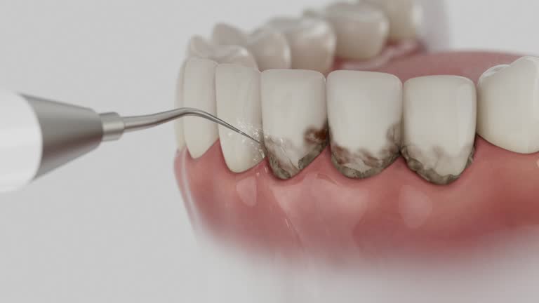 Trusted Tooth Extraction service in Ulysses, KS - Dentist Open Now
